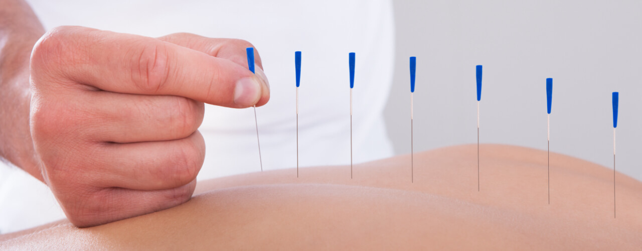https://therapywestpt.com/wp-content/uploads/2020/12/Dry-Needling-Therapy.jpg